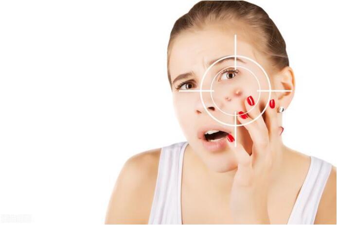 <strong>自制祛痘药膏！三甲配方终结红肿痘痘</strong>